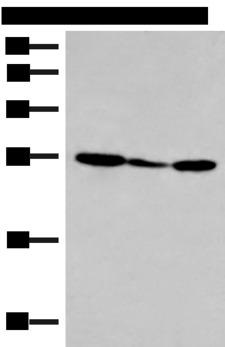 HLA-DOB Antibody - Western blot analysis of 293T cell lysate  using HLA-DOB Polyclonal Antibody at dilution of 1:400