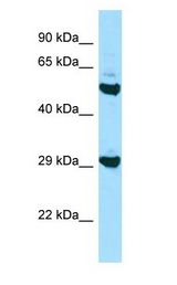 HLA-DOB Antibody - HLA-DOB antibody Western Blot of HepG2. Antibody dilution: 1 ug/ml.  This image was taken for the unconjugated form of this product. Other forms have not been tested.