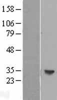 HLA-DOB Protein - Western validation with an anti-DDK antibody * L: Control HEK293 lysate R: Over-expression lysate