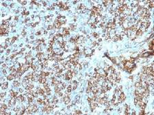 HLA-DP+DQ+DR Antibody - IHC testing of FFPE human tonsil tissue with HLA-DP/DQ/DR antibody (clone CR3/43). Required HIER: boil tissue sections in 10mM citrate buffer, pH 6, for 10-20 min.