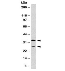 HLA-DP+DQ+DR Antibody - Western blot testing of human Raji cell lysate with HLA-DP/DQ/DR antibody (clone CR3/43). Expected molecular weight ~36 kDa (alpha chain) and ~27 kDa (beta chain).