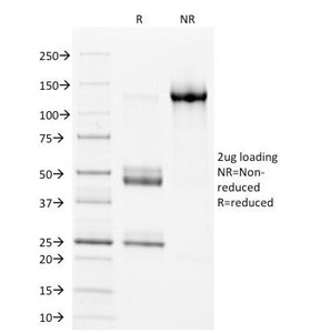 HLA-DP+DQ+DR Antibody - SDS-PAGE Analysis of Purified, BSA-Free HLA-DP/DQ/DR Antibody (clone CR3/43). Confirmation of Integrity and Purity of the Antibody.