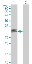 HLA-DPA1 Antibody - Western Blot analysis of HLA-DPA1 expression in transfected 293T cell line by HLA-DPA1 monoclonal antibody (M03), clone 1E3.Lane 1: HLA-DPA1 transfected lysate(29.3 KDa).Lane 2: Non-transfected lysate.