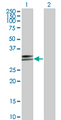 HLA-DPA1 Antibody - Western Blot analysis of HLA-DPA1 expression in transfected 293T cell line by HLA-DPA1 monoclonal antibody (M03), clone 1E3.Lane 1: HLA-DPA1 transfected lysate(29.3 KDa).Lane 2: Non-transfected lysate.