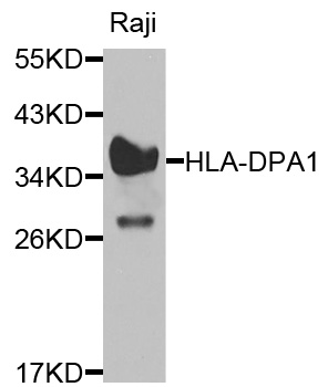 HLA-DPA1 Antibody - Western blot analysis of extracts of Raji cells, using HLA-DPA1 antibody at 1:1000 dilution. The secondary antibody used was an HRP Goat Anti-Rabbit IgG (H+L) at 1:10000 dilution. Lysates were loaded 25ug per lane and 3% nonfat dry milk in TBST was used for blocking.