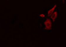 HLA-DPA1 Antibody - Staining HeLa cells by IF/ICC. The samples were fixed with PFA and permeabilized in 0.1% Triton X-100, then blocked in 10% serum for 45 min at 25°C. The primary antibody was diluted at 1:200 and incubated with the sample for 1 hour at 37°C. An Alexa Fluor 594 conjugated goat anti-rabbit IgG (H+L) antibody, diluted at 1/600, was used as secondary antibody.