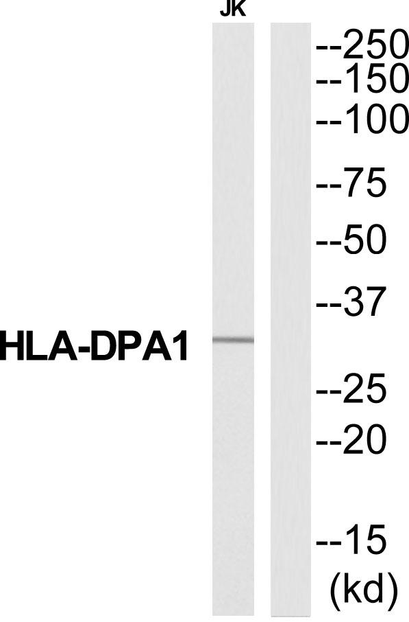 HLA-DPA1 Antibody - Western blot analysis of extracts from Jurkat cells, using HA2Q antibody.