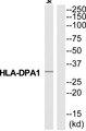 HLA-DPA1 Antibody - Western blot analysis of extracts from Jurkat cells, using HA2Q antibody.