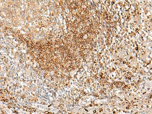 HLA-DPA1 Antibody - Immunohistochemistry of paraffin-embedded Human tonsil tissue  using HLA-DPA1 Polyclonal Antibody at dilution of 1:35(×200)