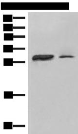 HLA-DPA1 Antibody - Western blot analysis of Raji cell Human spleen tissue lysates  using HLA-DPA1 Polyclonal Antibody at dilution of 1:400