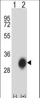 HLA-DPB1 Antibody - Western blot of HLA-DPB1 (arrow) using rabbit polyclonal HLA-DPB1 Antibody. 293 cell lysates (2 ug/lane) either nontransfected (Lane 1) or transiently transfected (Lane 2) with the HLA-DPB1 gene.