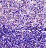 HLA-DPB1 Antibody - HLA-DPB1 Antibody immunohistochemistry of formalin-fixed and paraffin-embedded human tonsil tissue followed by peroxidase-conjugated secondary antibody and DAB staining.
