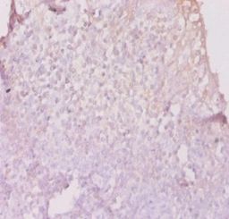 HLA-DPB1 Antibody - Immunohistochemistry of paraffin-embedded human tonsil using CSB-PA14809A0Rb at dilution of 1:50. This image was taken for the unconjugated form of this product. Other forms have not been tested.