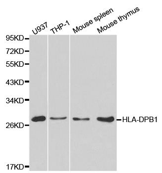 HLA-DPB1 Antibody - Western blot analysis of extracts of various cell lines, using HLA-DPB1 antibody at 1:1000 dilution. The secondary antibody used was an HRP Goat Anti-Rabbit IgG (H+L) at 1:10000 dilution. Lysates were loaded 25ug per lane and 3% nonfat dry milk in TBST was used for blocking.