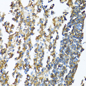 HLA-DPB1 Antibody - Immunohistochemistry of paraffin-embedded human lymphonodus using HLA-DPB1 antibodyat dilution of 1:100 (40x lens).