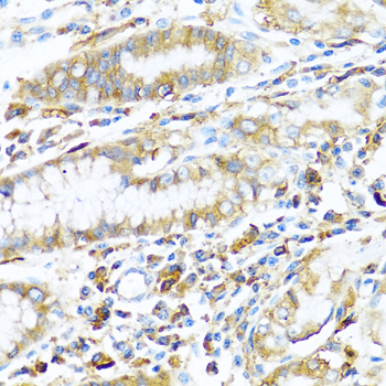 HLA-DPB1 Antibody - Immunohistochemistry of paraffin-embedded human stomach using HLA-DPB1 antibodyat dilution of 1:100 (40x lens).
