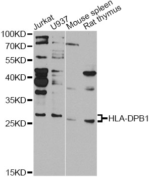 HLA-DPB1 Antibody - Western blot analysis of extracts of various cell lines, using HLA-DPB1 antibody at 1:1000 dilution. The secondary antibody used was an HRP Goat Anti-Rabbit IgG (H+L) at 1:10000 dilution. Lysates were loaded 25ug per lane and 3% nonfat dry milk in TBST was used for blocking. An ECL Kit was used for detection and the exposure time was 90s.