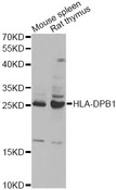 HLA-DPB1 Antibody - Western blot analysis of extracts of various cell lines, using HLA-DPB1 antibody at 1:1000 dilution. The secondary antibody used was an HRP Goat Anti-Rabbit IgG (H+L) at 1:10000 dilution. Lysates were loaded 25ug per lane and 3% nonfat dry milk in TBST was used for blocking. An ECL Kit was used for detection and the exposure time was 30s.