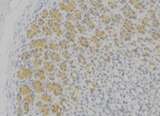 HLA-DPB1 Antibody - 1:100 staining human gastric tissue by IHC-P. The sample was formaldehyde fixed and a heat mediated antigen retrieval step in citrate buffer was performed. The sample was then blocked and incubated with the antibody for 1.5 hours at 22°C. An HRP conjugated goat anti-rabbit antibody was used as the secondary.