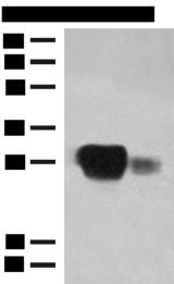 HLA-DPB1 Antibody - Western blot analysis of Raji cell and Human spleen tissue lysates  using HLA-DPB1 Polyclonal Antibody at dilution of 1:350