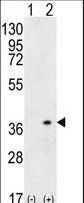 HLA-DQA1 Antibody - Western blot of HLA-DQA1 (arrow) using rabbit polyclonal HLA-DQA1 Antibody. 293 cell lysates (2 ug/lane) either nontransfected (Lane 1) or transiently transfected (Lane 2) with the HLA-DQA1 gene.