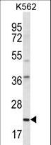 HLA-DQA1 Antibody - HLA-DQA1 Antibody western blot of K562 cell line lysates (35 ug/lane). The HLA-DQA1 antibody detected the HLA-DQA1 protein (arrow).