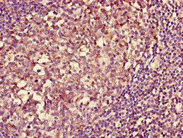 HLA-DQA1 Antibody - Immunohistochemistry of paraffin-embedded human tonsil tissue using HLA-DQA1 Antibody, Biotin conjugated at dilution of 1:100