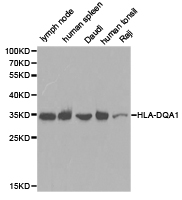 HLA-DQA1 Antibody - Western blot of extracts of various cell lines, using HLA-DQA1 antibody.