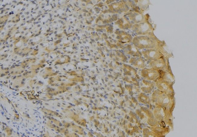 HLA-DQA1 Antibody - 1:100 staining human gastric tissue by IHC-P. The sample was formaldehyde fixed and a heat mediated antigen retrieval step in citrate buffer was performed. The sample was then blocked and incubated with the antibody for 1.5 hours at 22°C. An HRP conjugated goat anti-rabbit antibody was used as the secondary.