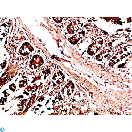 HLA-DQA1 Antibody - Immunohistochemical analysis of paraffin-embedded human-colon, antibody was diluted at 1:200.