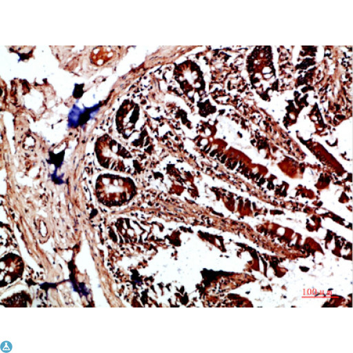 HLA-DQA1 Antibody - Immunohistochemical analysis of paraffin-embedded human-colon, antibody was diluted at 1:200.