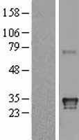 HLA-DQA1 Protein - Western validation with an anti-DDK antibody * L: Control HEK293 lysate R: Over-expression lysate