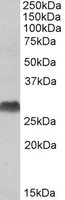 HLA-DQA2 Antibody - HLA-DQA2 antibody (1 ug/ml) staining of Human Bone Marrow lysate (35 ug protein/ml in RIPA buffer). Primary incubation was 1 hour. Detected by chemiluminescence.