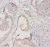 HLA-DQA2 Antibody - Immunohistochemistry of paraffin-embedded human prostate tissue using HLA-DQA2 Antibody at dilution of 1:20