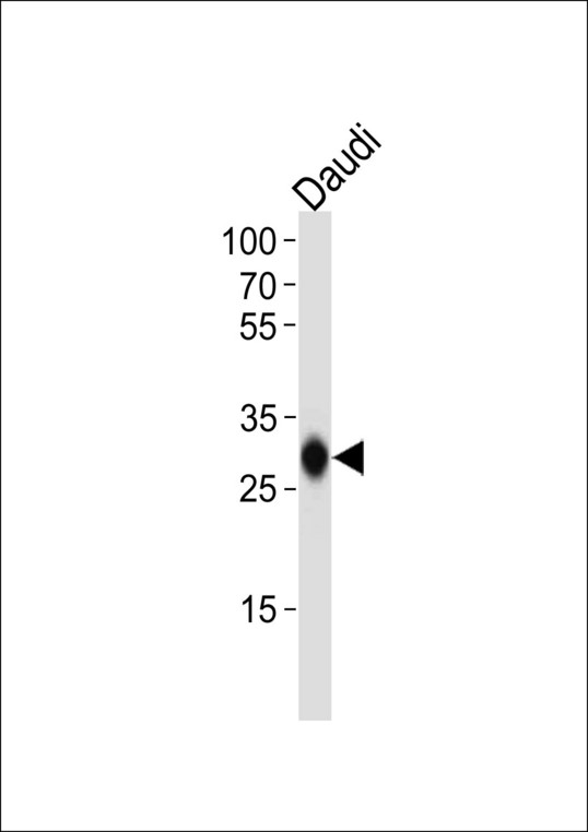 HLA-DQB1 Antibody - HLA-DQB1 Antibody western blot of Daudi cell line lysates (35 ug/lane). The HLA-DQB1 antibody detected the HLA-DQB1 protein (arrow).