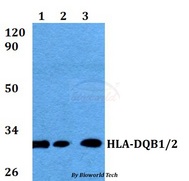 HLA-DQB1 Antibody - Western blot of HLA-DQB1/B2 antibody at 1:500 dilution. Lane 1: HEK293T whole cell lysate. Lane 2: Raw264.7 whole cell lysate. Lane 3: PC12 whole cell lysate.