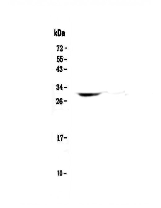 HLA-DQB1 Antibody - Western blot - Anti-HLA-DQB1/Hla Dqb1 Picoband antibody