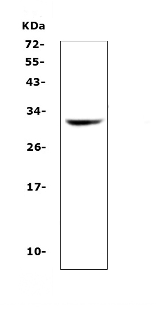 HLA-DQB1 Antibody - Western blot analysis of HLA-DQB1 using anti-HLA-DQB1 antibody. Electrophoresis was performed on a 5-20% SDS-PAGE gel at 70V (Stacking gel) / 90V (Resolving gel) for 2-3 hours. The sample well of each lane was loaded with 50ug of sample under reducing conditions. Lane 1: human SK-OV-3 whole cell lysates. After Electrophoresis, proteins were transferred to a Nitrocellulose membrane at 150mA for 50-90 minutes. Blocked the membrane with 5% Non-fat Milk/ TBS for 1.5 hour at RT. The membrane was incubated with rabbit anti-HLA-DQB1 antigen affinity purified polyclonal antibody at 0.5 µg/mL overnight at 4°C, then washed with TBS-0.1% Tween 3 times with 5 minutes each and probed with a goat anti-rabbit IgG-HRP secondary antibody at a dilution of 1:10000 for 1.5 hour at RT. The signal is developed using an Enhanced Chemiluminescent detection (ECL) kit with Tanon 5200 system. A specific band was detected for HLA-DQB1 at approximately 30KD. The expected band size for HLA-DQB1 is at 30KD.