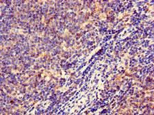 HLA-DQB1 Antibody - Immunohistochemistry of paraffin-embedded human lymph node tissue at dilution of 1:100