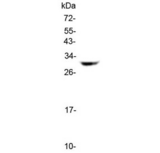 HLA-DQB1 Antibody - Western blot testing of human SK-OV-3 cell lysate with HLA-DQB1 antibody at 0.5ug/ml. Predicted molecular weight ~30 kDa.