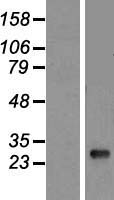HLA-DQB1 Protein - Western validation with an anti-DDK antibody * L: Control HEK293 lysate R: Over-expression lysate