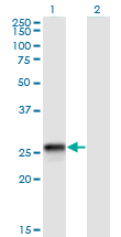 HLA-DQB2 Antibody - Western Blot analysis of HLA-DQB2 expression in transfected 293T cell line by HLA-DQB2 monoclonal antibody (M01), clone 4C3.Lane 1: HLA-DQB2 transfected lysate (Predicted MW: 26.5 KDa).Lane 2: Non-transfected lysate.