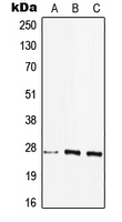HLA-DQB2 Antibody - Western blot analysis of HLA-DQB2 expression in HEK293T (A); MCF7 (B); Raw264.7 (C) whole cell lysates.