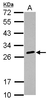 HLA-DQB2 Antibody - Sample (30 ug of whole cell lysate) A: K562 12% SDS PAGE HLA-DQB2 antibody diluted at 1:1000