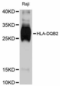 HLA-DQB2 Antibody - Western blot analysis of extracts of Raji cells, using HLA-DQB2 antibody at 1:3000 dilution. The secondary antibody used was an HRP Goat Anti-Rabbit IgG (H+L) at 1:10000 dilution. Lysates were loaded 25ug per lane and 3% nonfat dry milk in TBST was used for blocking. An ECL Kit was used for detection and the exposure time was 30s.
