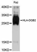 HLA-DQB2 Antibody - Western blot analysis of extracts of Raji cells, using HLA-DQB2 antibody at 1:3000 dilution. The secondary antibody used was an HRP Goat Anti-Rabbit IgG (H+L) at 1:10000 dilution. Lysates were loaded 25ug per lane and 3% nonfat dry milk in TBST was used for blocking. An ECL Kit was used for detection and the exposure time was 30s.