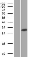 HLA-DQB2 Protein - Western validation with an anti-DDK antibody * L: Control HEK293 lysate R: Over-expression lysate