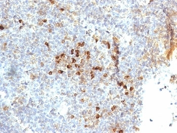 HLA-DR Antibody - Formalin-fixed, paraffin-embedded human tonsil stained with HLA-DR antibody (19-26.1).  This image was taken for the unmodified form of this product. Other forms have not been tested.