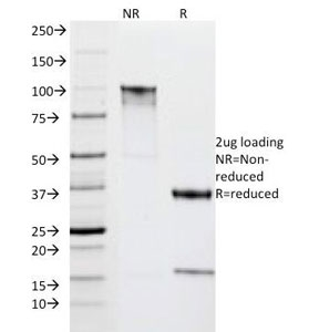 HLA-DR Antibody - SDS-PAGE Analysis of Purified, BSA-Free HLA-DR Antibody (clone IPO-10). Confirmation of Integrity and Purity of the Antibody.