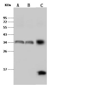HLA-DR Antibody - Anti-HLA-DR rabbit polyclonal antibody at 1:500 dilution. Lane A: Raji Whole Cell Lysate. Lane B: Daudi Whole Cell Lysate. Lane C: HuT-78 Whole Cell Lysate. Lysates/proteins at 30 ug per lane. Secondary: Goat Anti-Rabbit IgG (H+L)/HRP at 1/10000 dilution. Developed using the ECL technique. Performed under reducing conditions. Predicted band size: 29 kDa. Observed band size: 33 kDa.